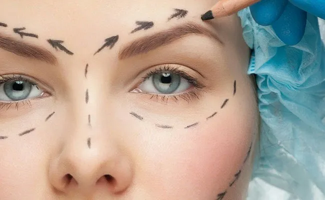 Blefaroplastia en Málaga: Inversión en Tu Mirada, Inversión en Ti Mismo